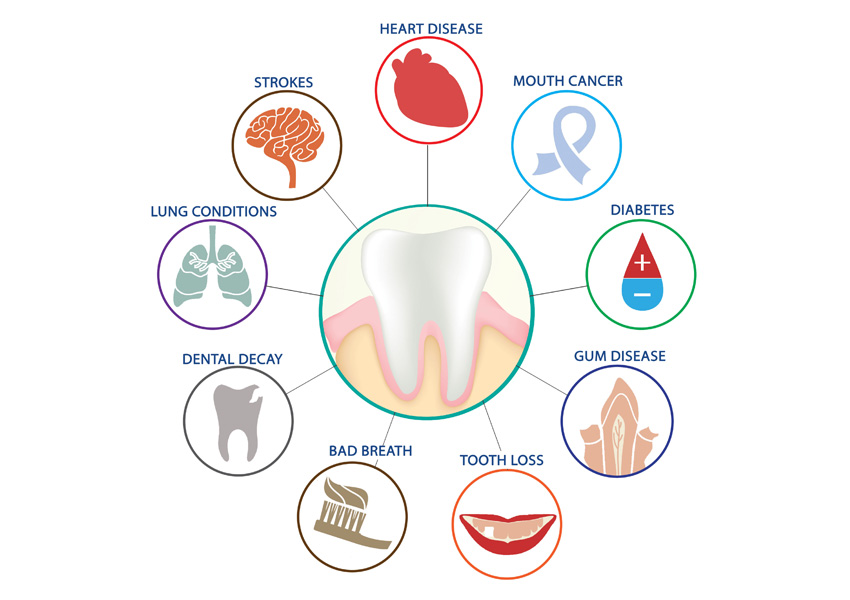 Ryšys tarp burnos sveikatos ir bendros gerovės: Ką reikia žinoti